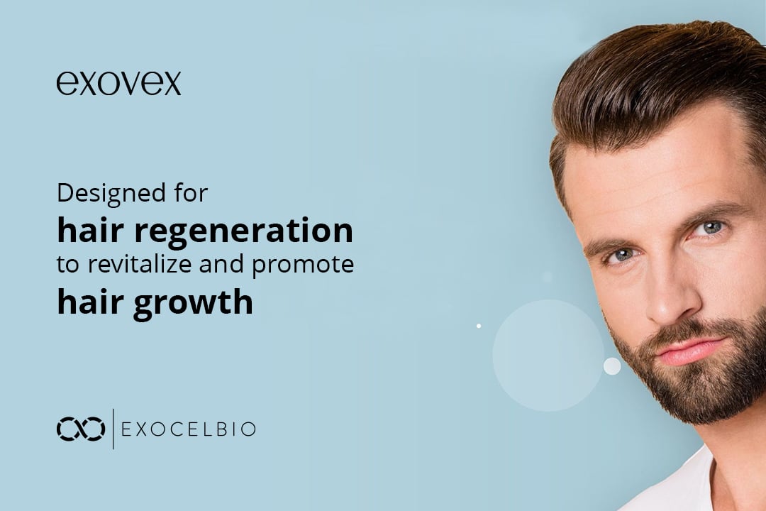 exovex-for-web-pic-3