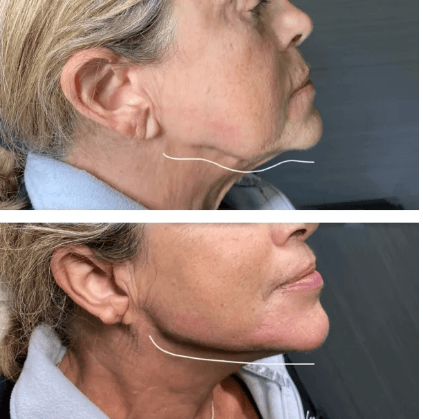 image_2022-08-02_101442182