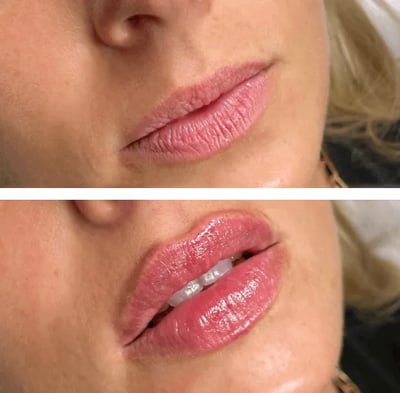 image_2022-08-02_101653501-1